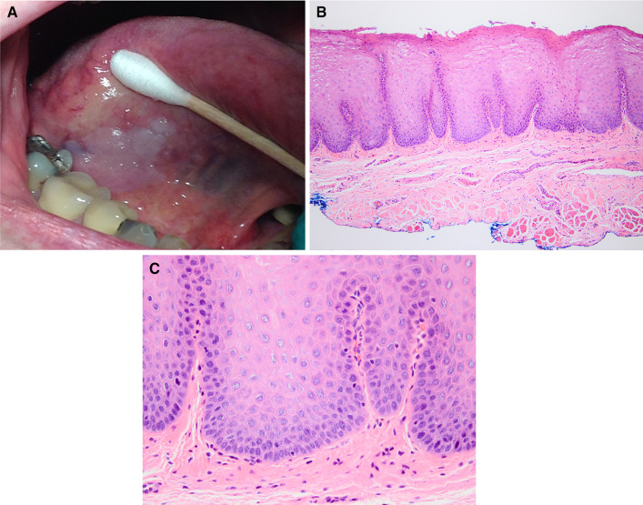 Fig. 6