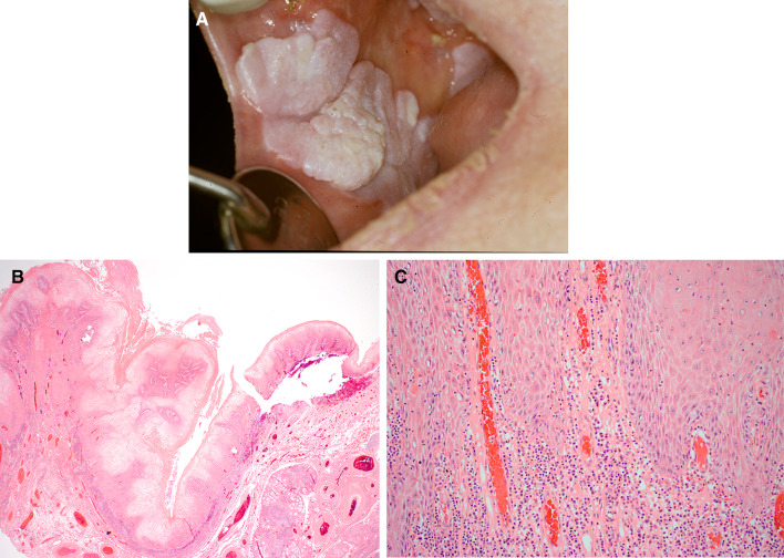 Fig. 12