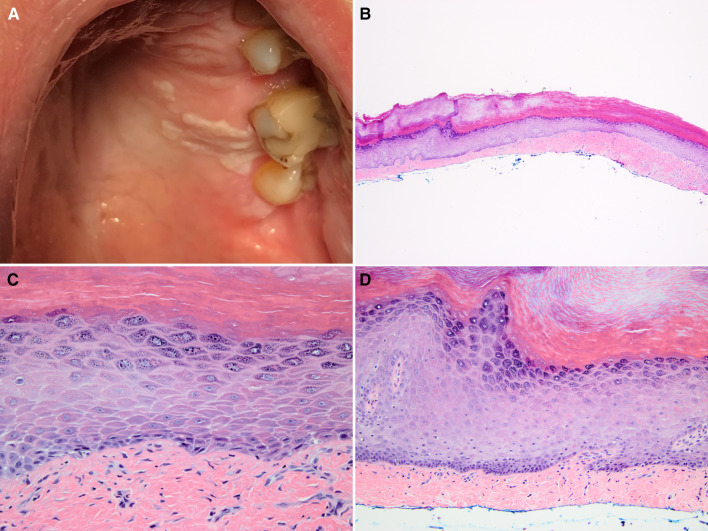 Fig. 4