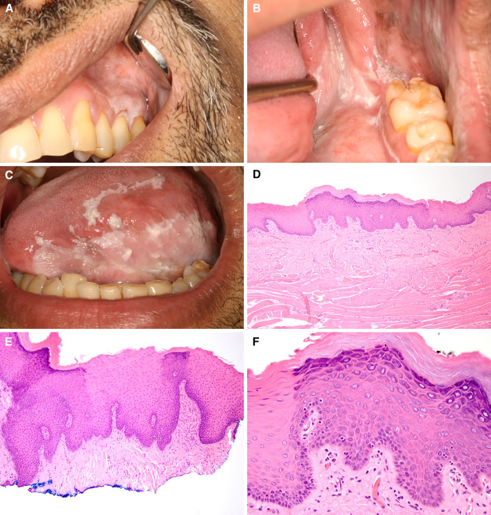 Fig. 11