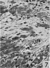 2-3