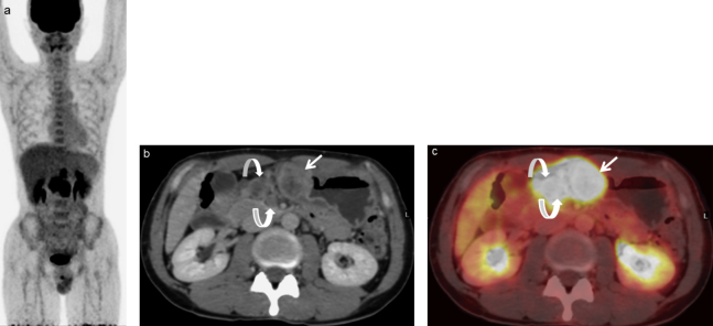 Fig. 4