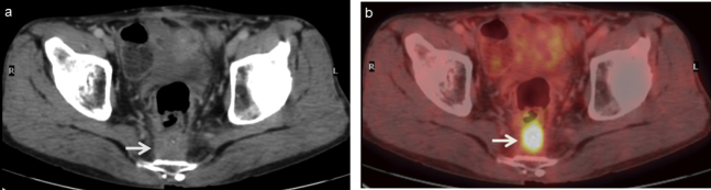 Fig. 7