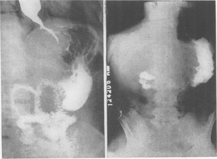 Fig. 1., Fig. 2.