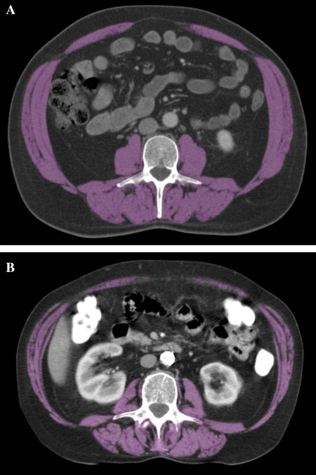 Fig. 1