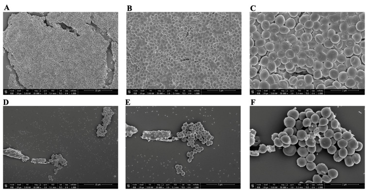 Figure 11