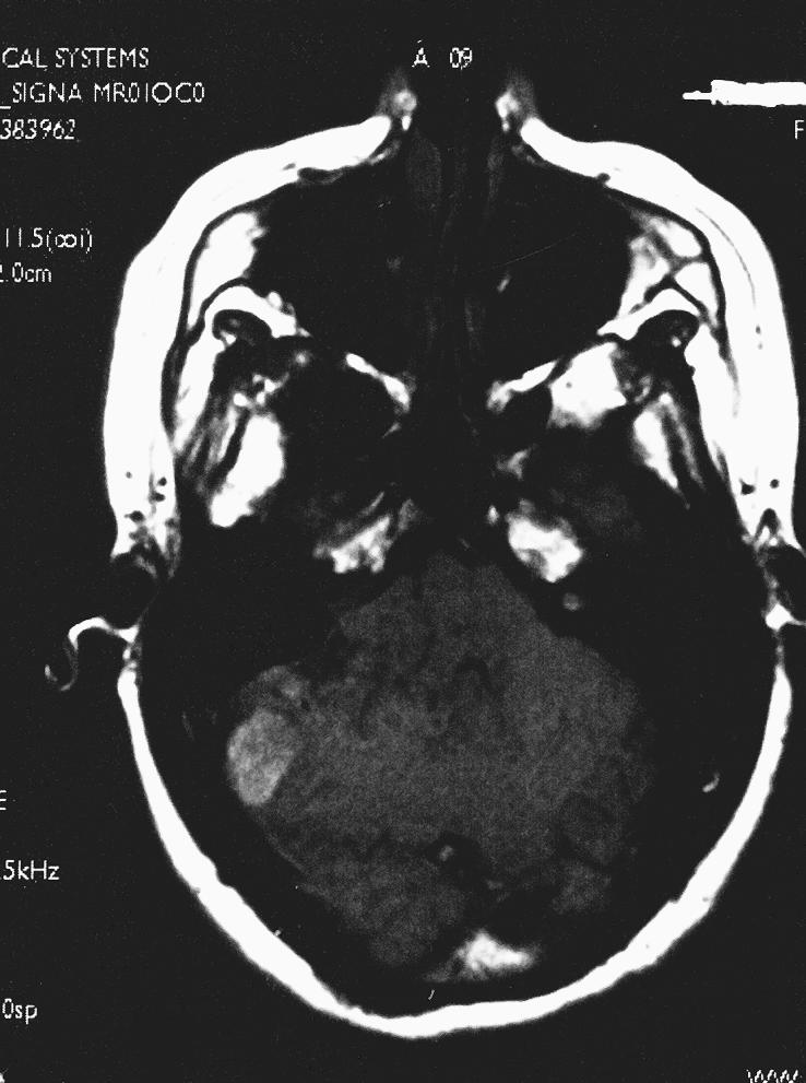 Figure 1A