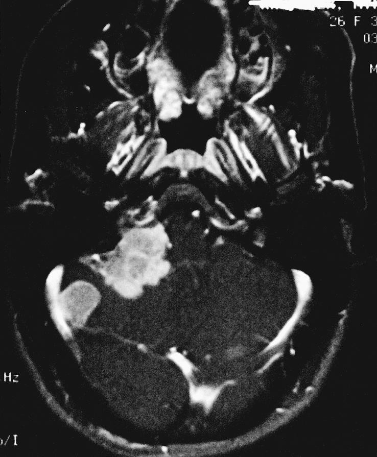 Figure 1C