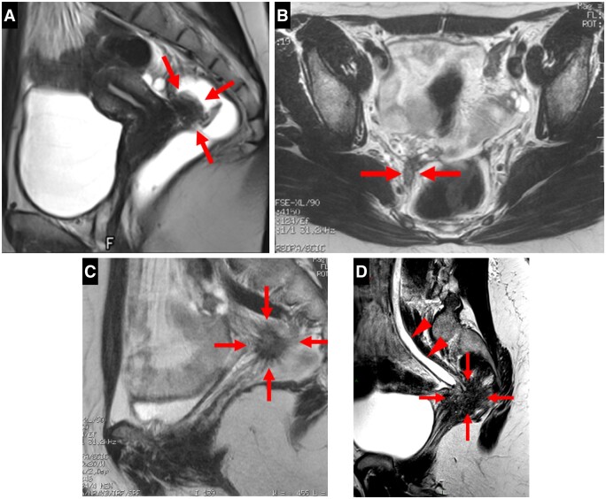 Figure 6.