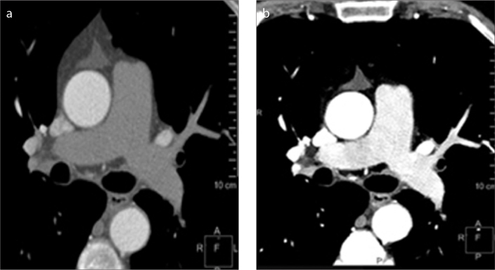 Figure 3. a, b