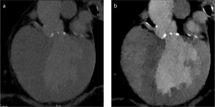 Figure 5. a, b