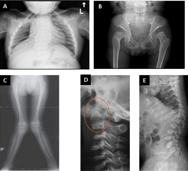 FIG. 3