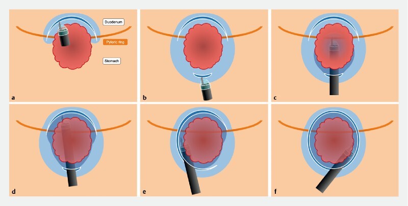 Fig. 3