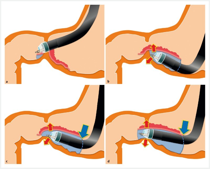 Fig. 2