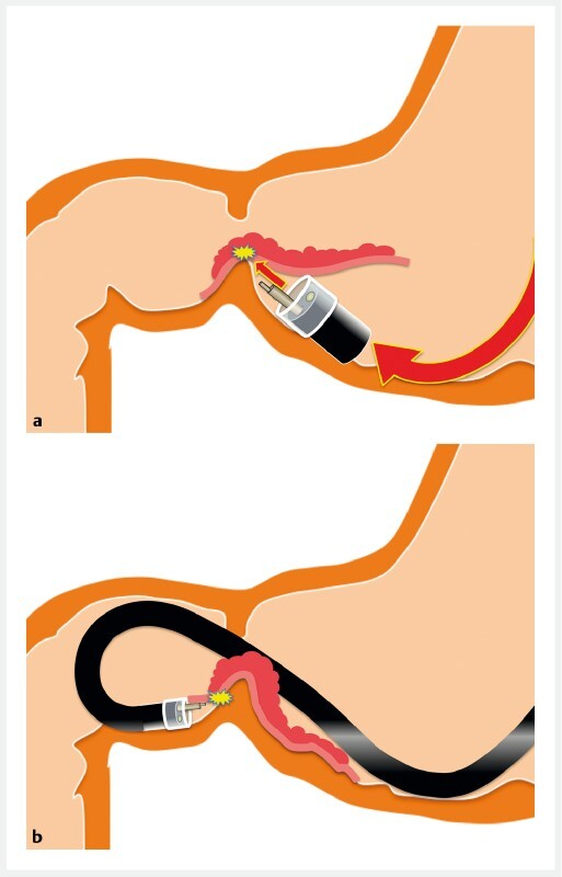 Fig. 1