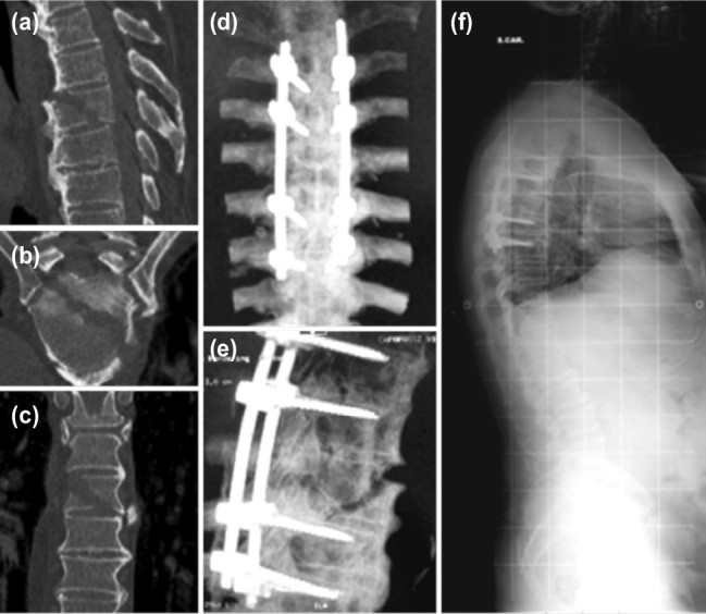 Fig. 2: