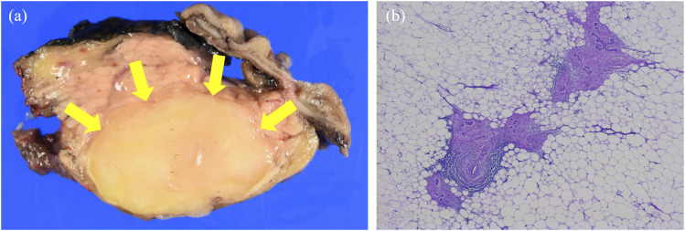 Fig 3.