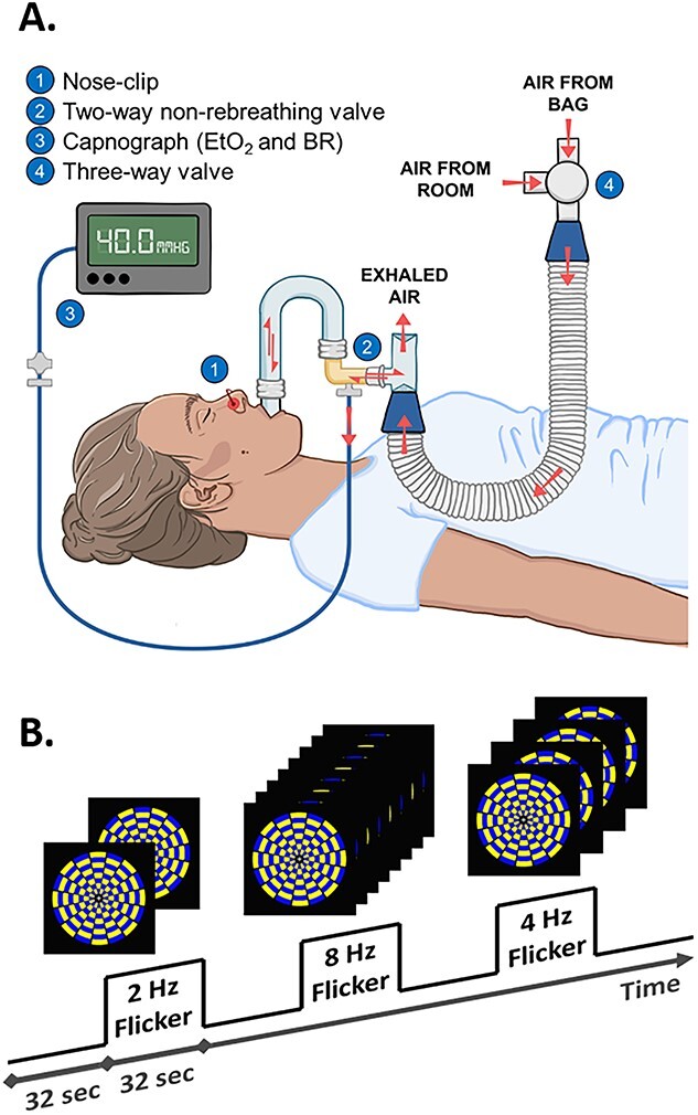 Fig. 1