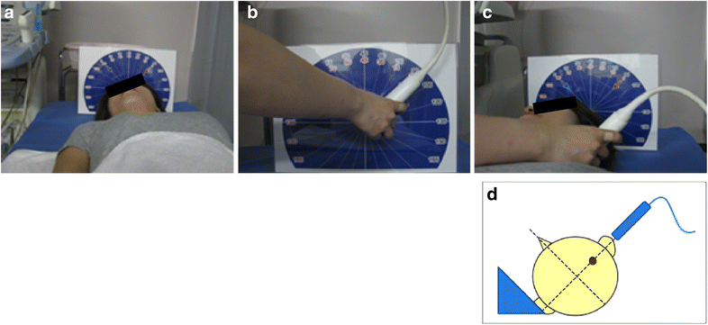 Fig. 2