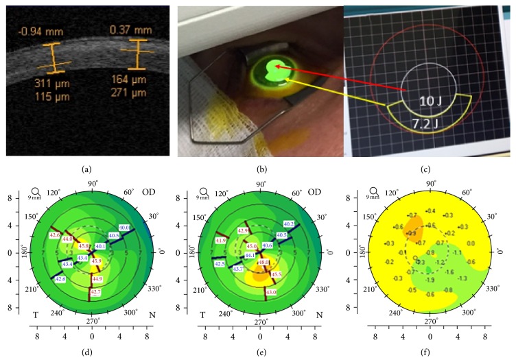 Figure 4