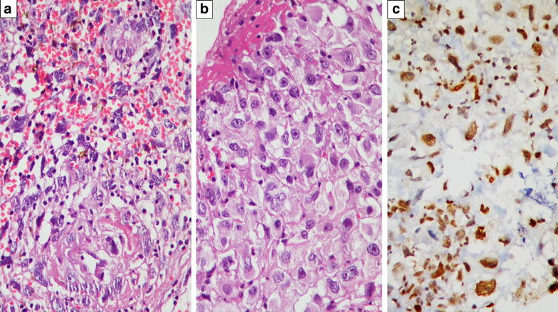 Fig. 2