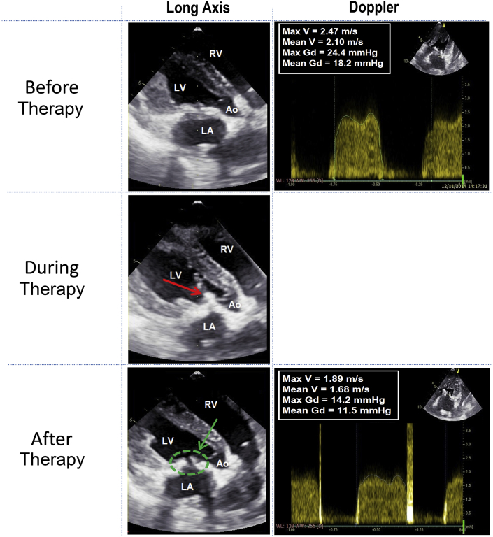 Figure 4