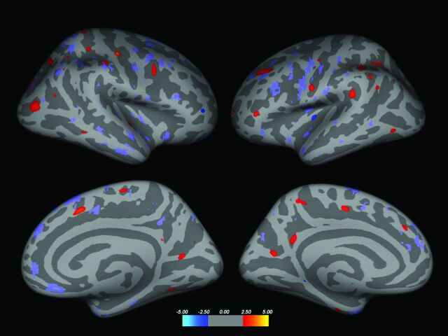 Fig 3.