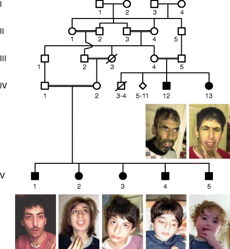 Fig. 1