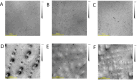 Fig. 11