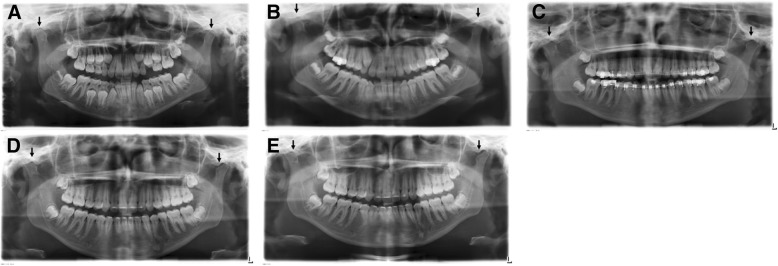 Fig. 5