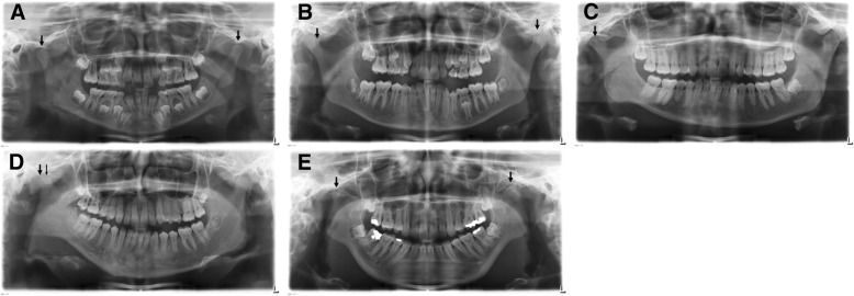 Fig. 4