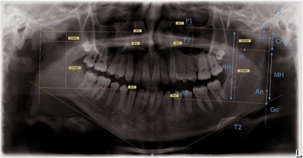 Fig. 2