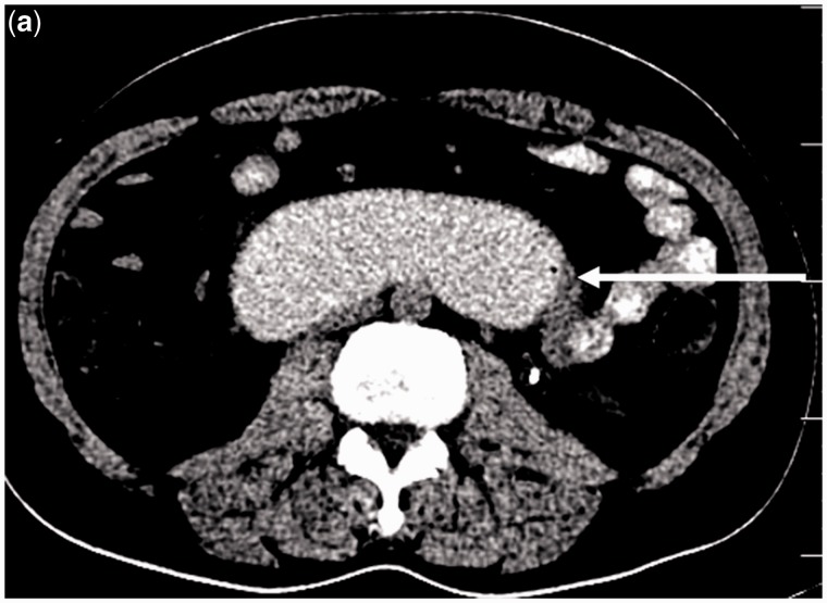 Figure 2a