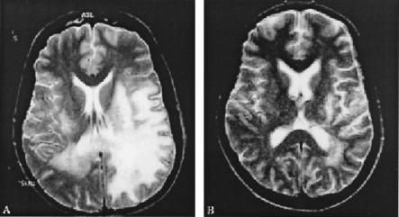 FIG. 8.