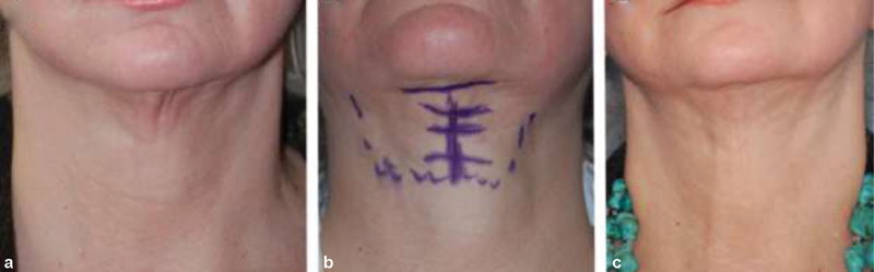 Fig. 9