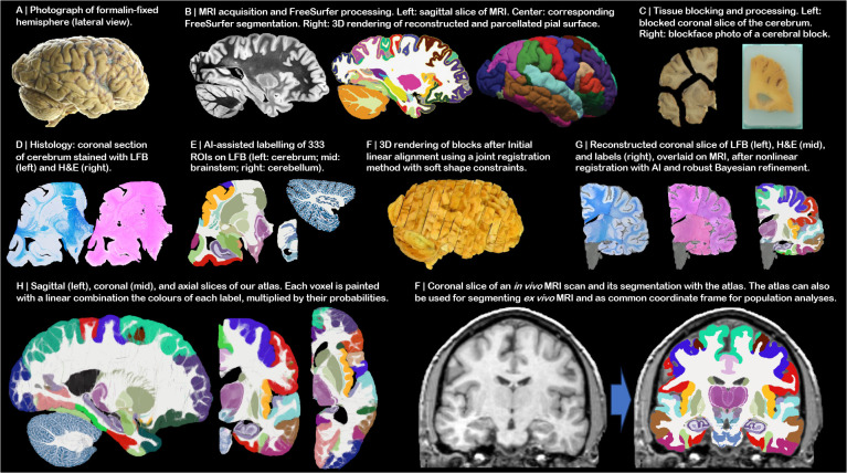 Fig 2: