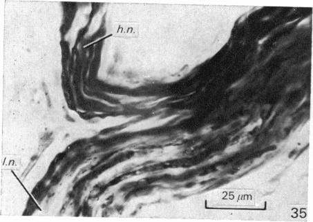 Fig. 35