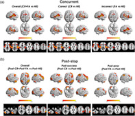 graphic file with name HBM-42-2677-g003.jpg