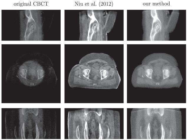 Fig. 15