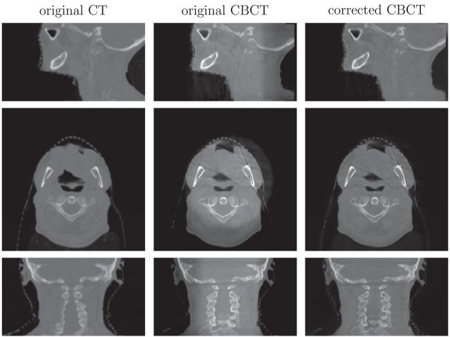 Fig. 12