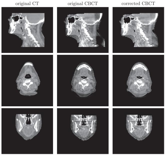 Fig. 13