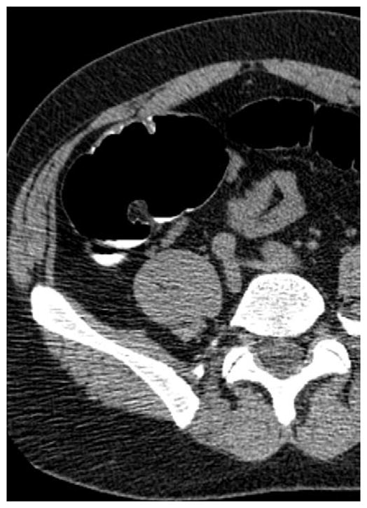 FIGURE 17