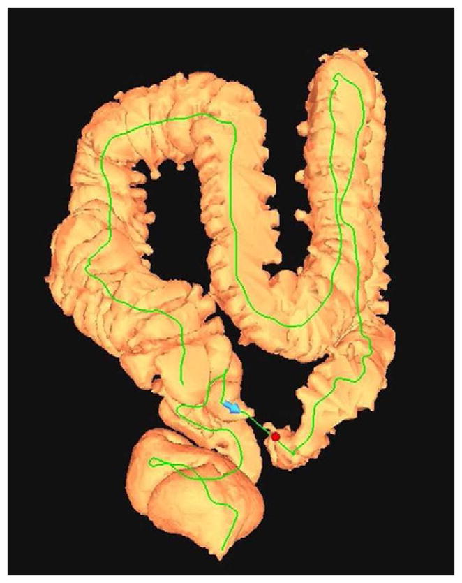 FIGURE 16