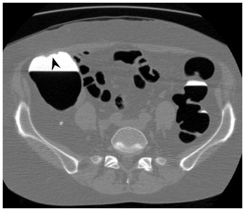 FIGURE 3