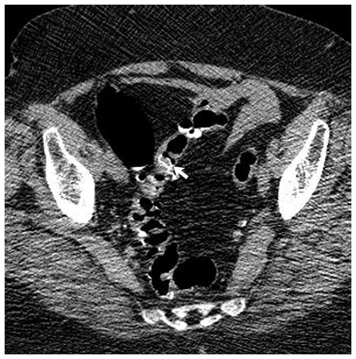 FIGURE 4