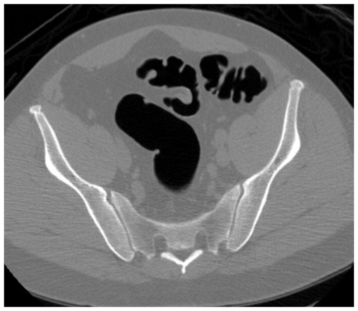 FIGURE 13