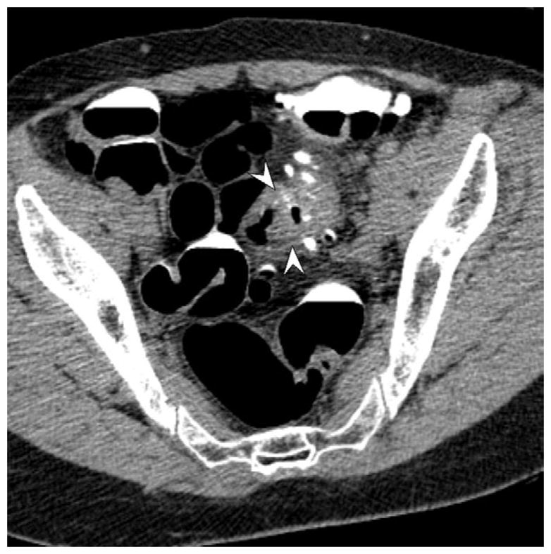 FIGURE 15