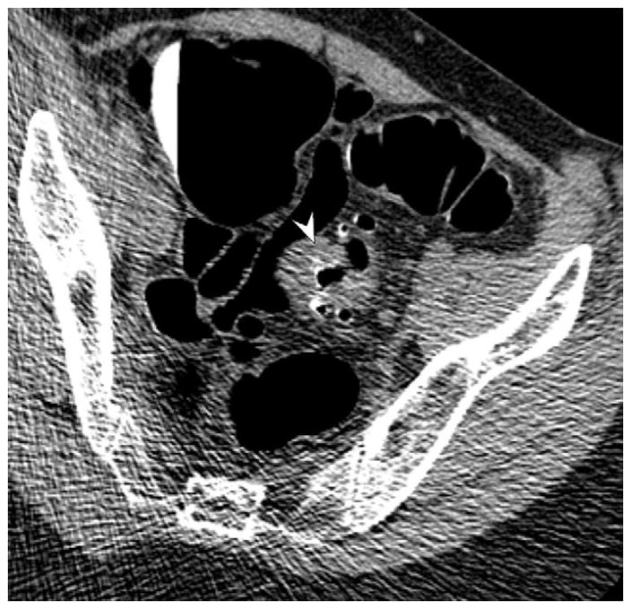 FIGURE 16