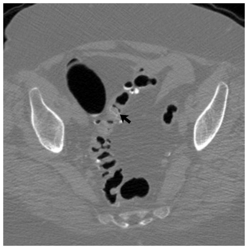 FIGURE 4