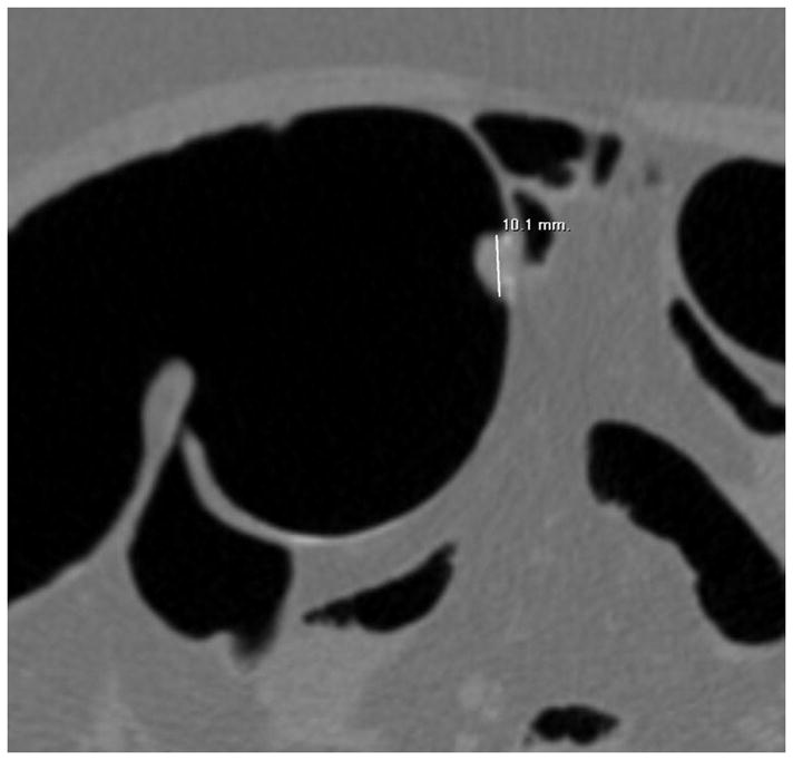 FIGURE 10